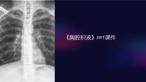 《胸腔积液》课件