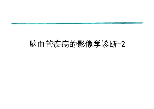 【影像诊断课件】脑血管疾病的影像学诊断-2