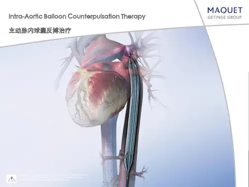 iabp操作(机器及植入)方法技巧-精选文档54页