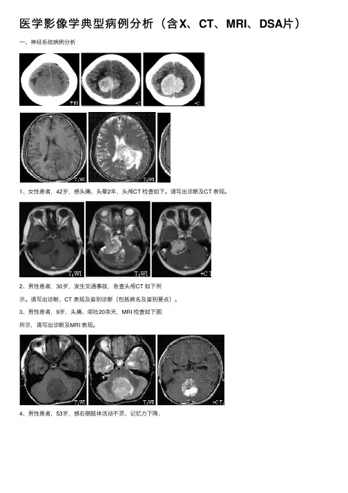 医学影像学典型病例分析（含X、CT、MRI、DSA片）