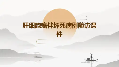 肝细胞癌伴坏死病例随访课件