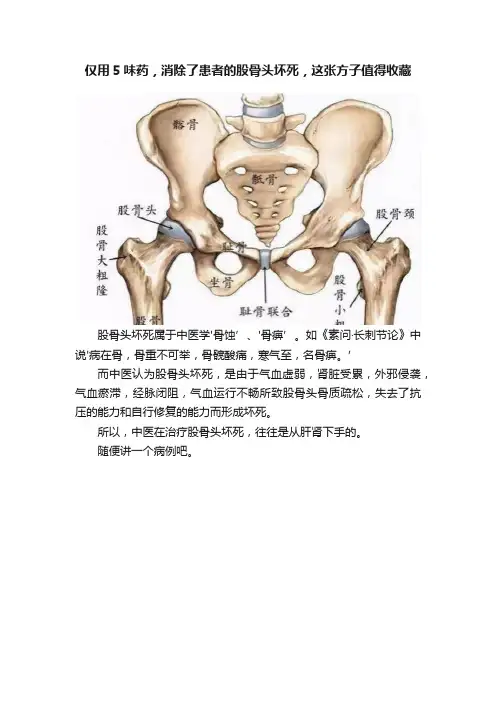 仅用5味药，消除了患者的股骨头坏死，这张方子值得收藏