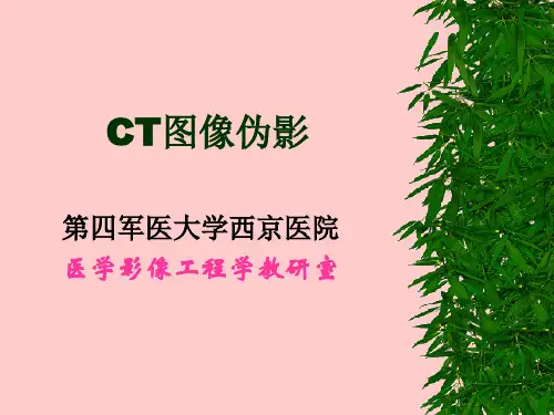 CT影像伪影和原因