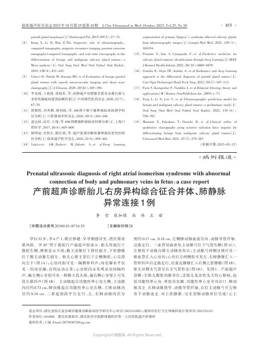 产前超声诊断胎儿右房异构综合征合并体、肺静脉异常连接1例