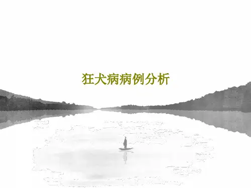 狂犬病病例分析共34页