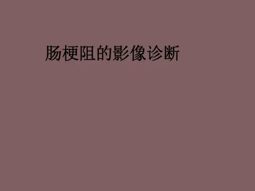 肠梗阻的影像诊断