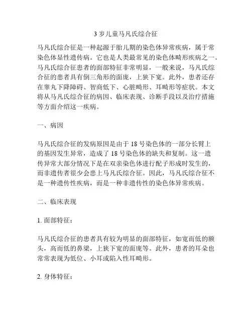 3岁儿童马凡氏综合征