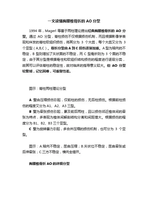 一文读懂胸腰椎骨折的AO分型