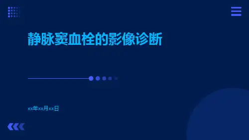 静脉窦血栓的影像诊断