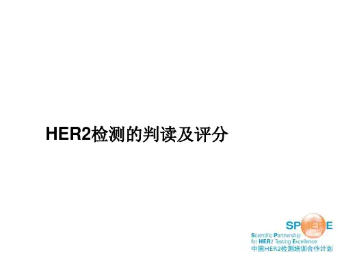 胃癌HER2判读及评分