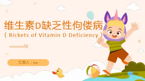 儿科维生素D缺乏性佝偻病-ppt课件