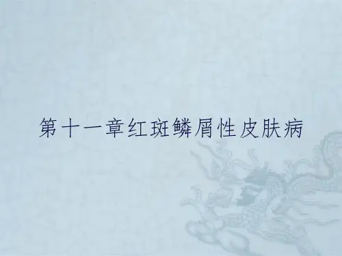 第十一章红斑鳞屑性皮肤病