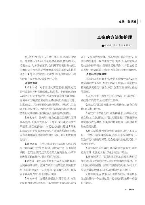 点痣的方法和护理
