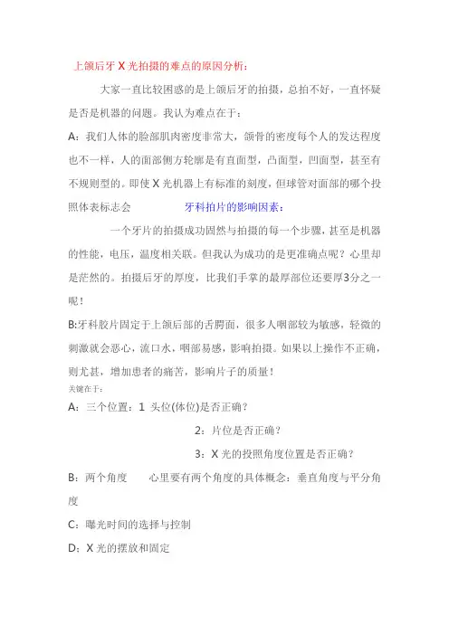 牙科x片的小技巧讲解