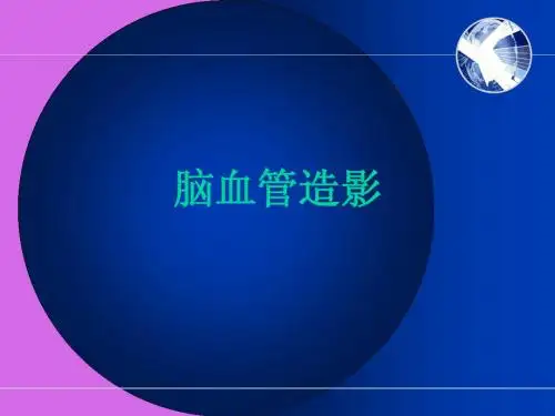 脑血管造影