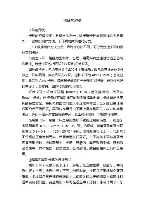 卡环的种类