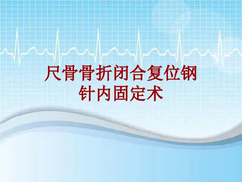 手术讲解模板：尺骨骨折闭合复位钢针内固定术