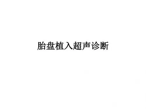 胎盘超声植入诊断17-8-24