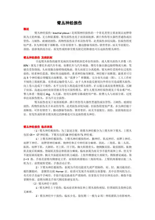 臂丛神经损伤(教学及宣教)