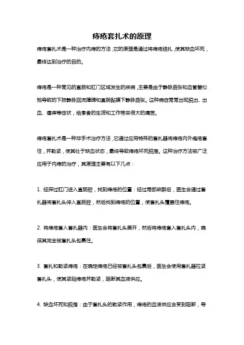 痔疮套扎术的原理