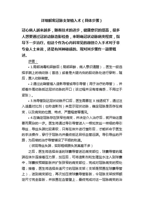 详细解密冠脉支架植入术（具体步骤）