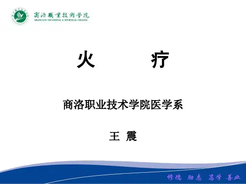 火疗