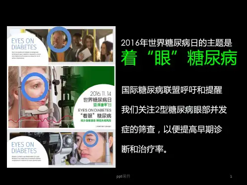 糖尿病视网膜病变ppt课件
