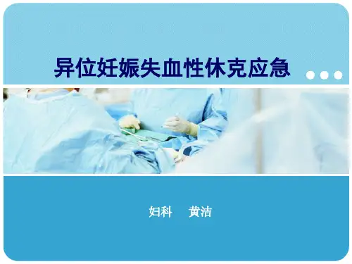 异位妊娠失血性休克ppt课件