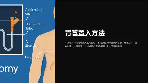《胃管置入方法》课件
