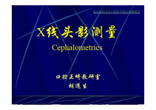 X线投影测量