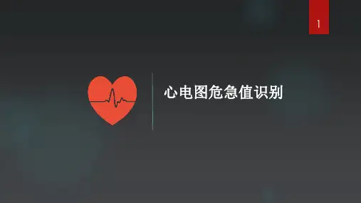 心电图危急值识别ppt课件