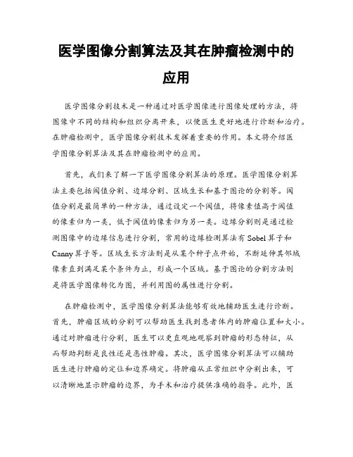 医学图像分割算法及其在肿瘤检测中的应用