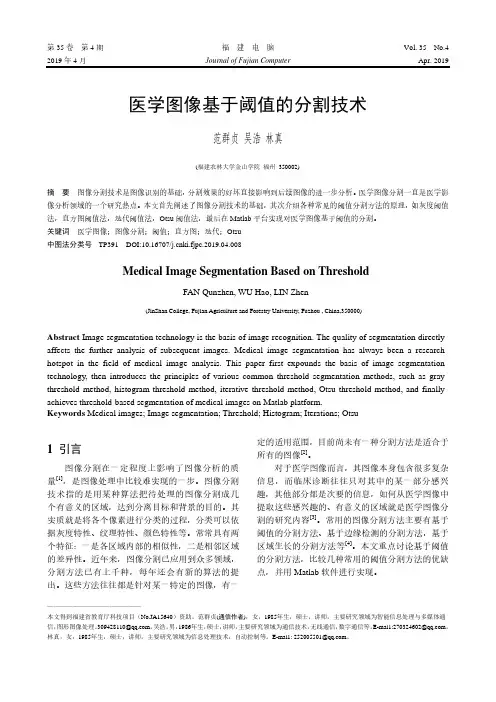 医学图像基于阈值的分割技术