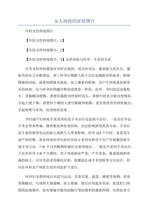 女人痔疮的症状图片