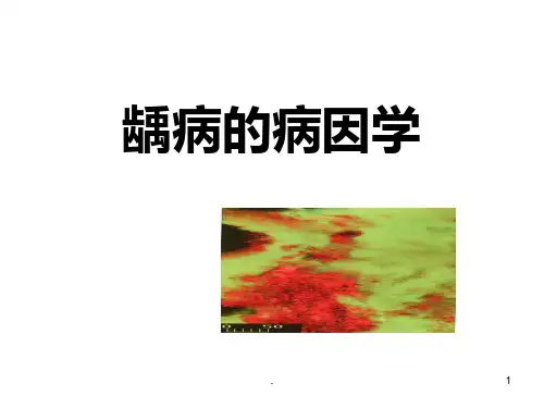 龋病病因学PPT课件