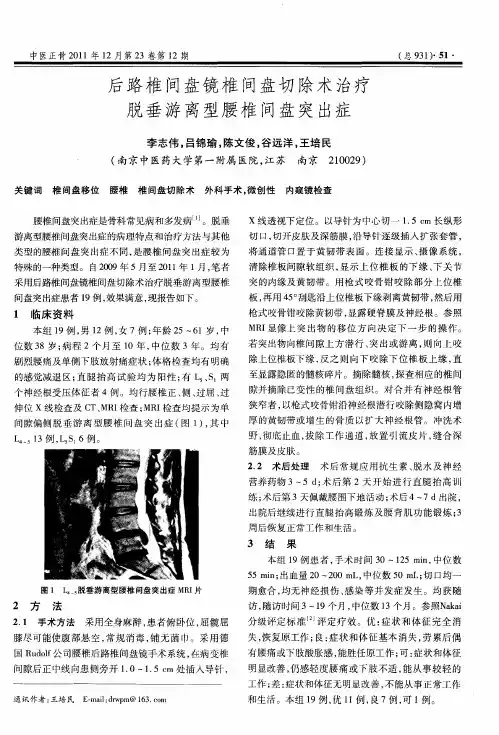 后路椎间盘镜椎间盘切除术治疗脱垂游离型腰椎间盘突出症