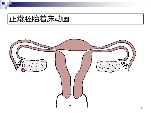 流产的相关知识PPT课件