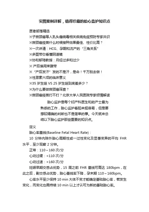 实图案例详解，值得珍藏的胎心监护知识点
