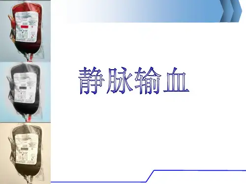 静脉输血  ppt课件