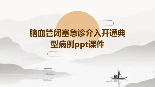 脑血管闭塞急诊介入开通典型病例PPT课件