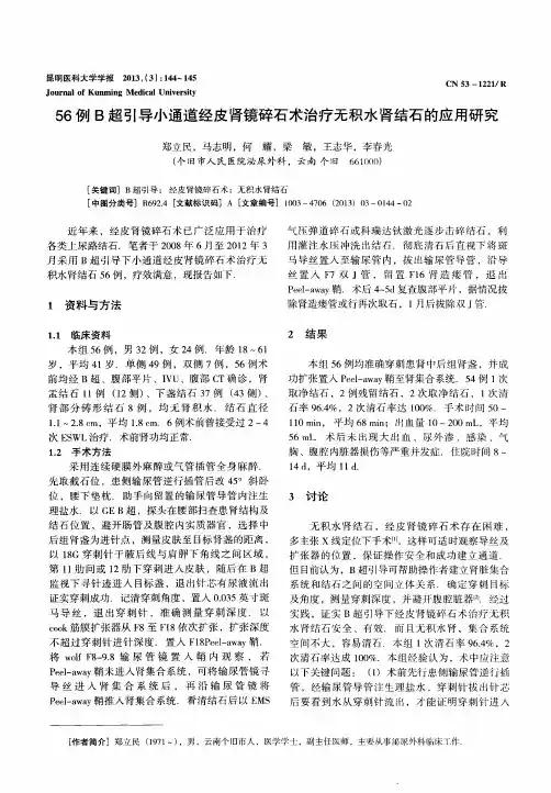 56例B超引导小通道经皮肾镜碎石术治疗无积水肾结石的应用研究