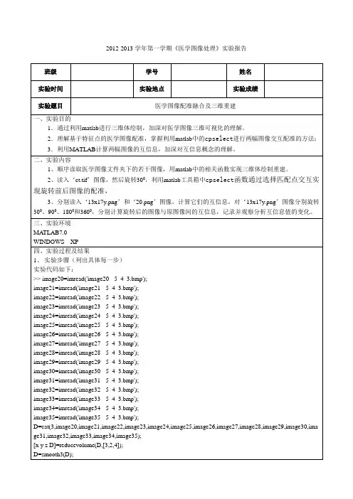 医学图像配准融合及三维重建