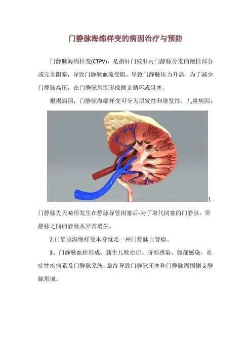 门静脉海绵样变的病因治疗与预防