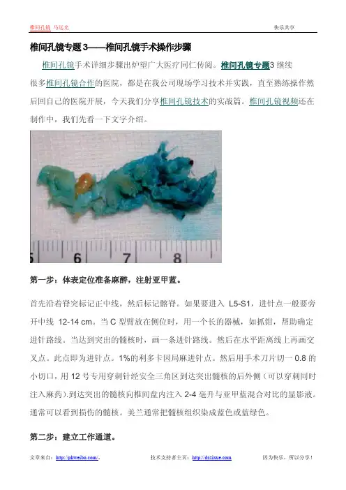 椎间孔镜专题3——椎间孔镜手术操作步骤