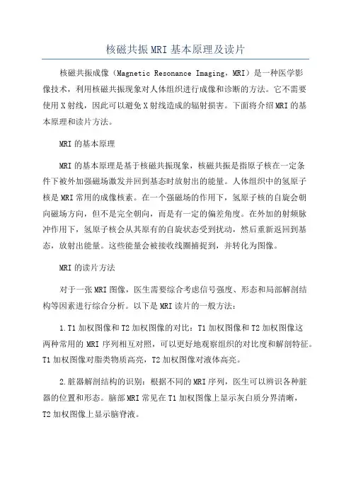 核磁共振MRI基本原理及读片