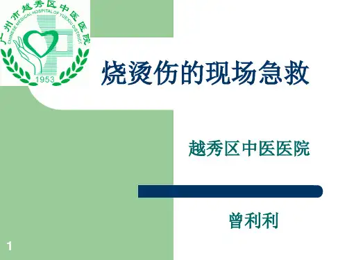 烧烫伤的现场急救ppt课件