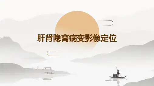 肝肾隐窝病变影像定位