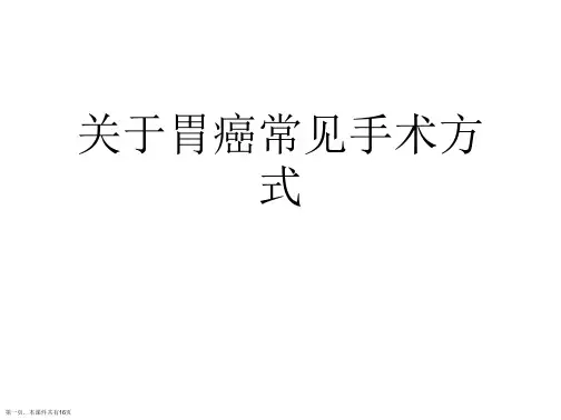 胃癌常见手术方式课件
