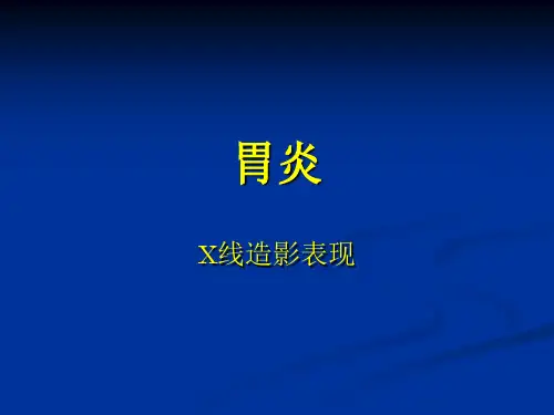 胃炎X线造影表现