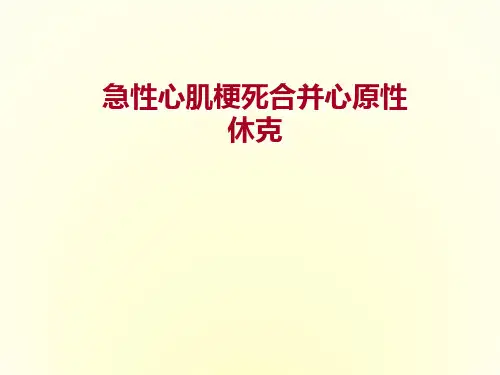 急性心肌梗死合并心源性休克